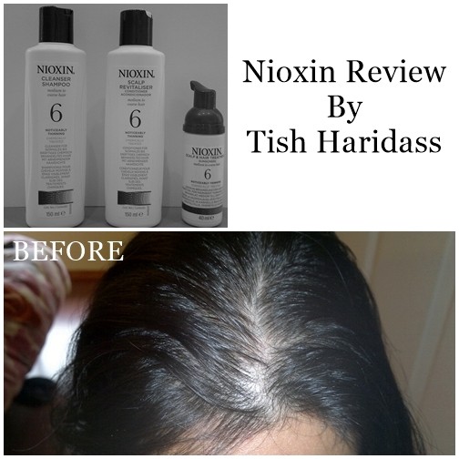 Read more about the article Nioxin Hair Treatment Kit No. 6